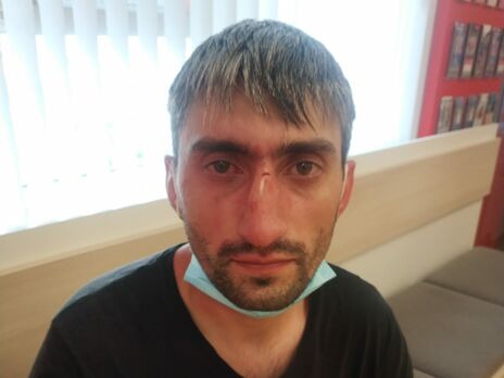 Антимайдановца Топаза избили в Киеве