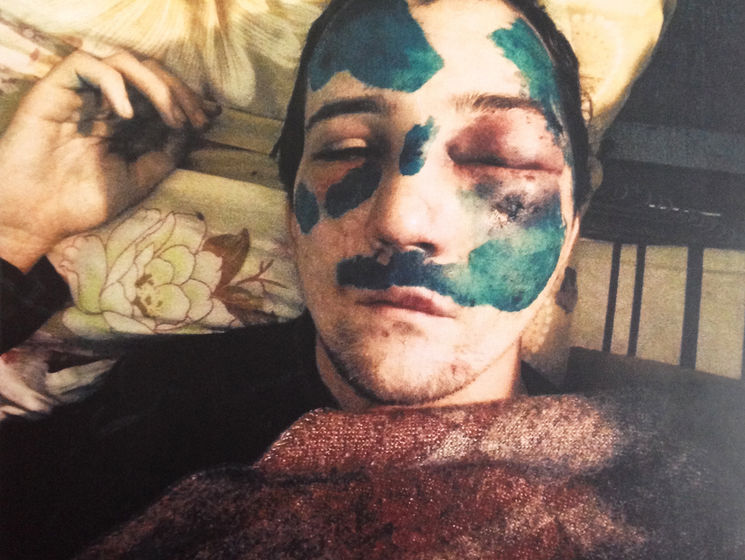 "Мне просто хотелось выжить". Суд заслушал показания активиста Майдана, избитого на колоннаде стадиона имени Лобановского 20 января 2014 года