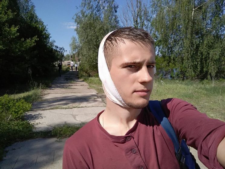 Журналист заявил, что во время столкновений возле имения Левочкина полицейский ударил его по голове