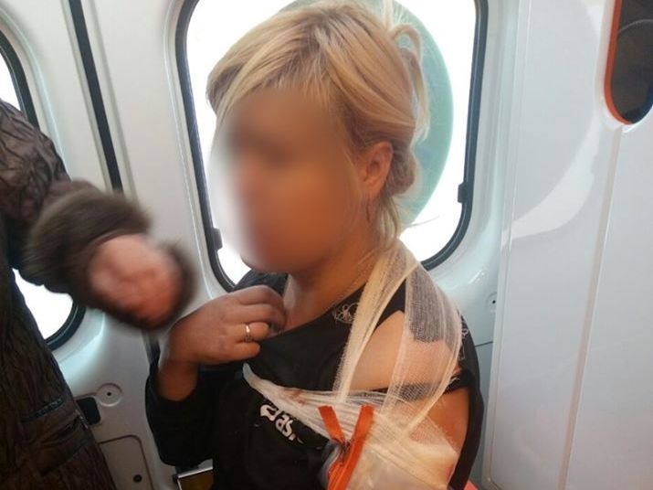 ﻿В Марьинке женщина получила ранения в результате обстрела боевиков – штаб ООС