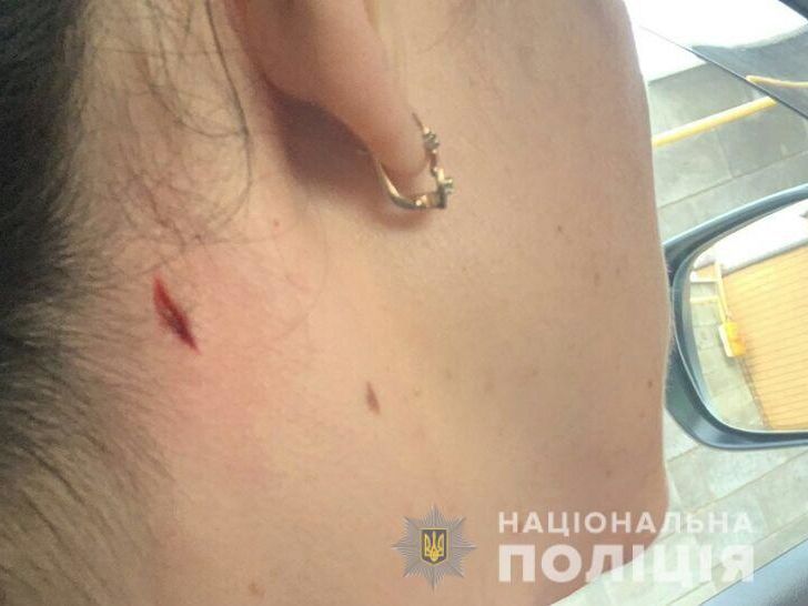 ﻿У Миколаєві жінка постраждала під час стрільб поліцейських