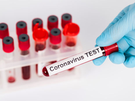 По мнению ученых, быстрые тесты позволят органам здравоохранения применять более целенаправленные меры по предотвращению распространения COVID-19