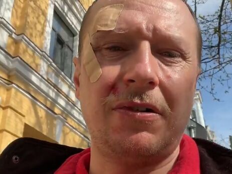 У Києві телеведучого Майкла Щура побив водій самоката