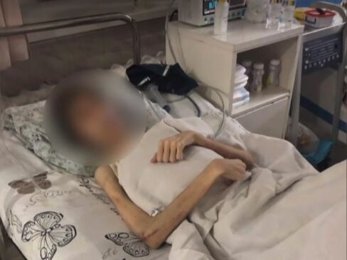 В Одесі в лікарню потрапив підліток, якого батьки довели до анорексії спробами "вигнати демонів"
