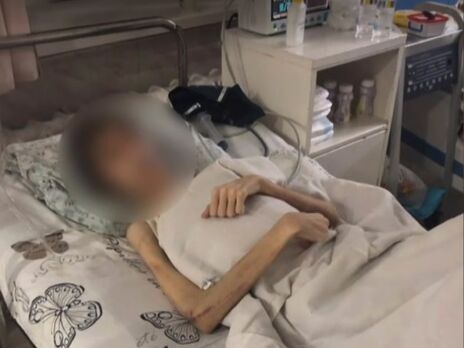 В Одесі в лікарню потрапив підліток, якого батьки довели до анорексії спробами 