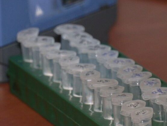 В Польше начались испытания украинской вакцины от коронавируса. Ее хотят выпускать в виде таблеток, микстуры или спрея