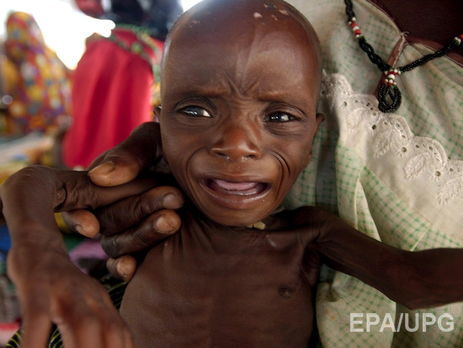 ООН: В Нигерии около 75 тысяч детей могут умереть от голода через несколько месяцев