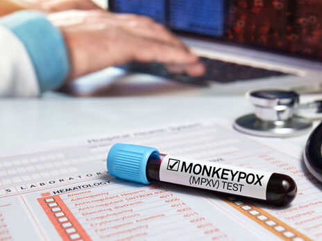 Замість monkeypox захворювання тепер офіційно називають mpox