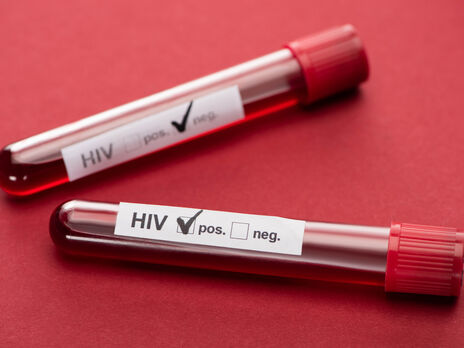 Україна посідає одне з перших місць серед країн європейського регіону за кількістю ВІЛ-позитивних осіб