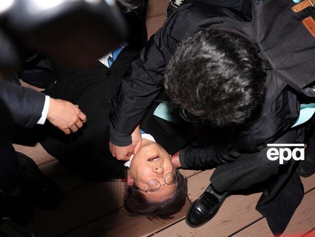 У Південній Кореї чоловік із ножем напав на лідера опозиційної партії