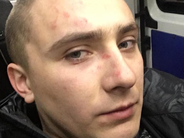 Екс-лідер одеського "Правого сектору" Стерненко повідомив, що Труханов організував на нього напад