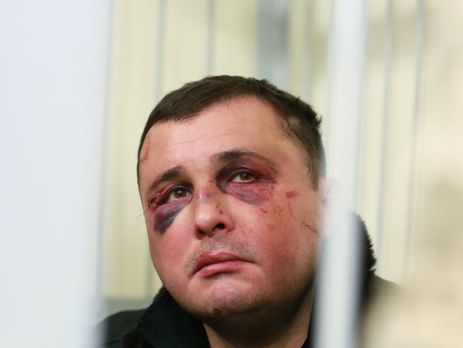 Экс-нардеп Шепелев: Криминалитет, который меня похитил, работает как на украинские спецслужбы, так и на ФСБ России