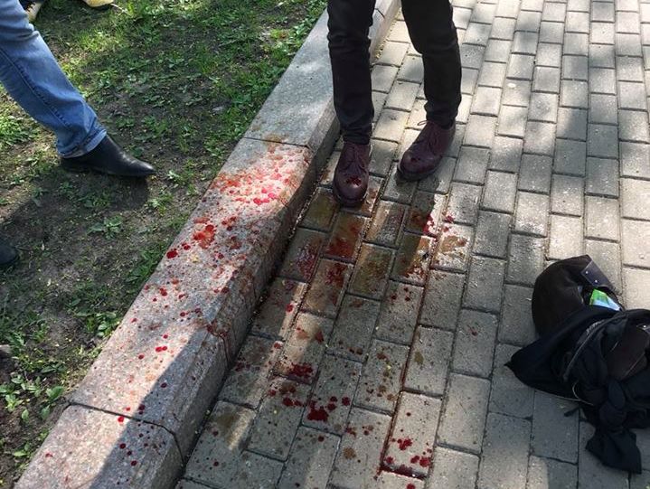 Під час акції 5 травня в Москві зламали ніс чоловікові, який сфотографував "козака"