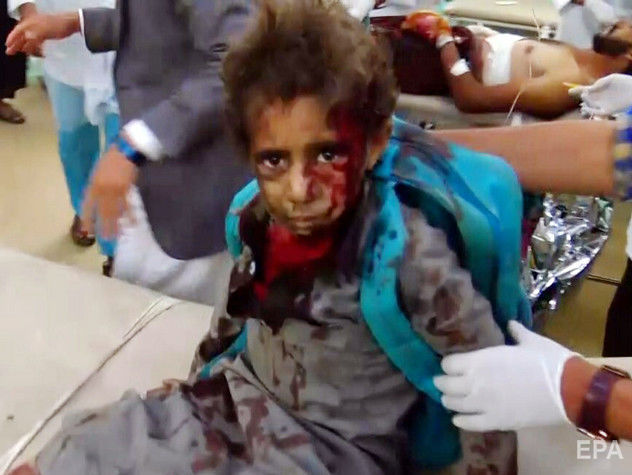 ﻿У Ємені ракета влучила в автобус із дітьми, загинули десятки людей